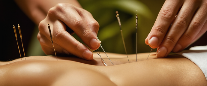 Incorporating Acupuncture in Arthritis Pain Relief Strategies