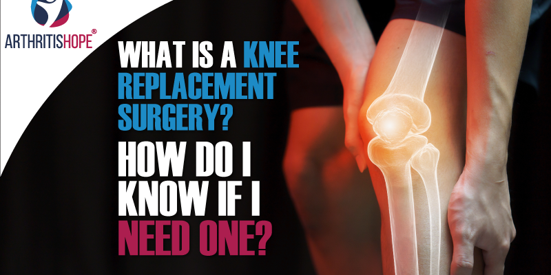 What is a Knee Replacement and how do I know if I need one?