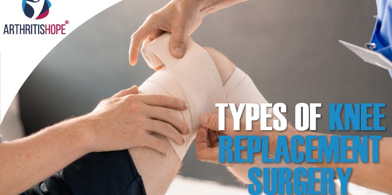 Types of Knee Replacement Surgery