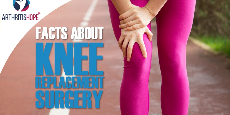 Facts About Knee Replacement